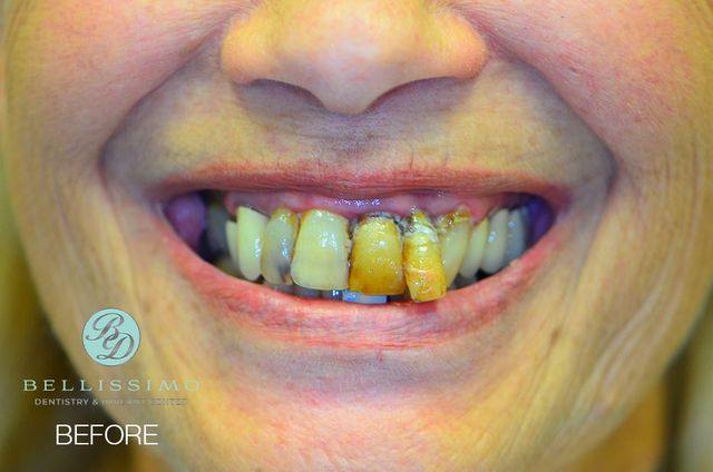 Smile Gallery | Bellissimo Dentistry & Implant Center | Chandler, AZ